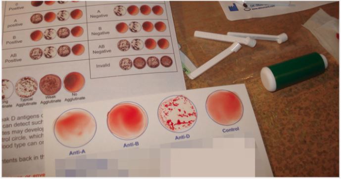 血型 檢測 A型 B型 C型 O型 AB型 LiFe生活化學