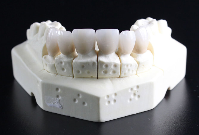 牙齒構造, 牙齒美白, 美白牙齒成份, 美白牙膏, LiFe生活化學